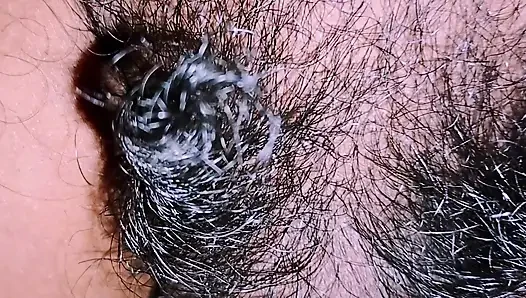 Long hair of penis