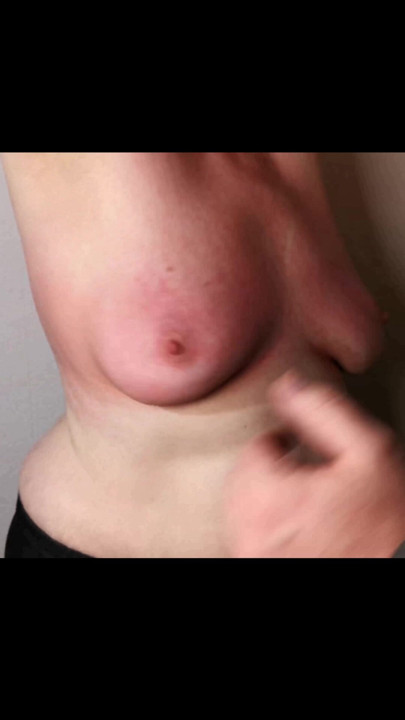 Tapa nos dois peitos