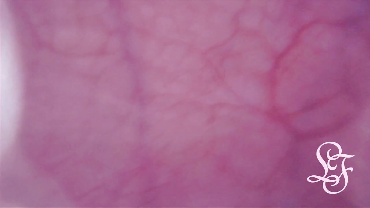 Bulge INSIDE my Bladder from Anal
