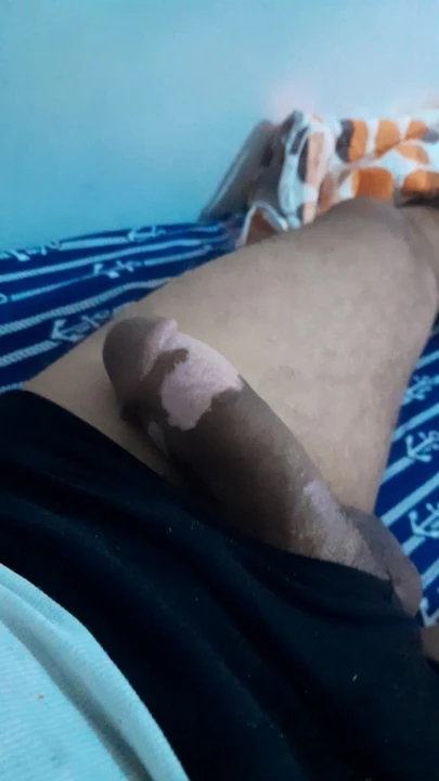 Zabi ymot 3la li tnik malor. Njibhalha w nafta7a malor bla manawja3ha