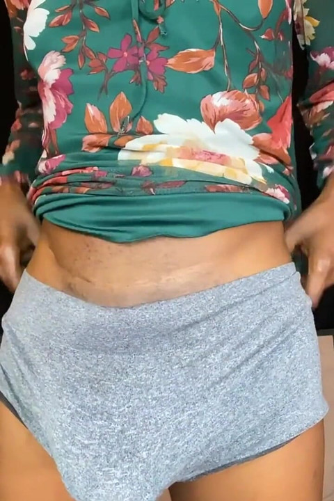 梅林的隆起想要自由