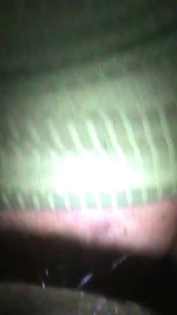 Ilaj njen dečko | Klip 1