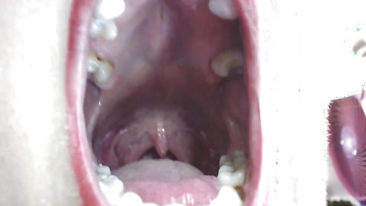 Inside My Big Mouth Tongue Teeth Uvula