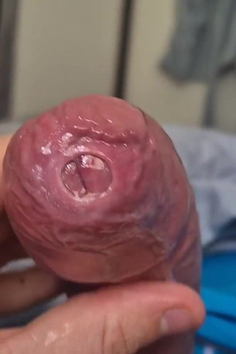Phimosis Cock Precum Drip Close-up