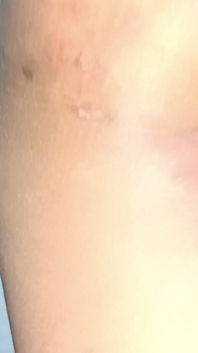 18 Year, Teen, School, College, Anal, Fingering, Forplay, Asian, Desi, Indian, Couple, Young Old, Cuckold, Homemade, Teen, | Clip 1