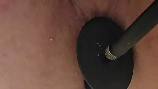 Anal tıkaç yok