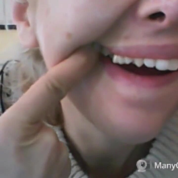 หน้าสวย แต่ฟันเน่า!