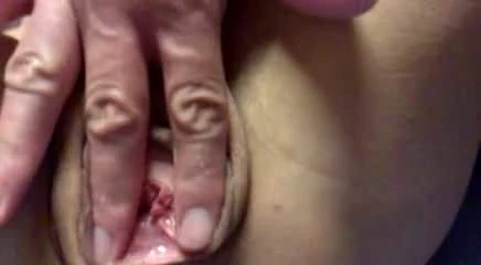 kenyeztetes 1