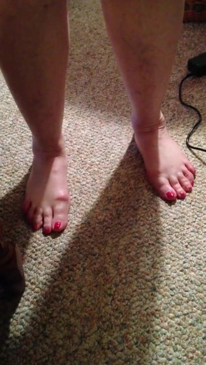 Mother in Law wiggling her toes for me