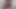 I Put the Microphone on My Hairy Cunt. Close-up of the Big Labia on My Cunt