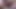 针头折磨极端 35 针在龟头视频 1