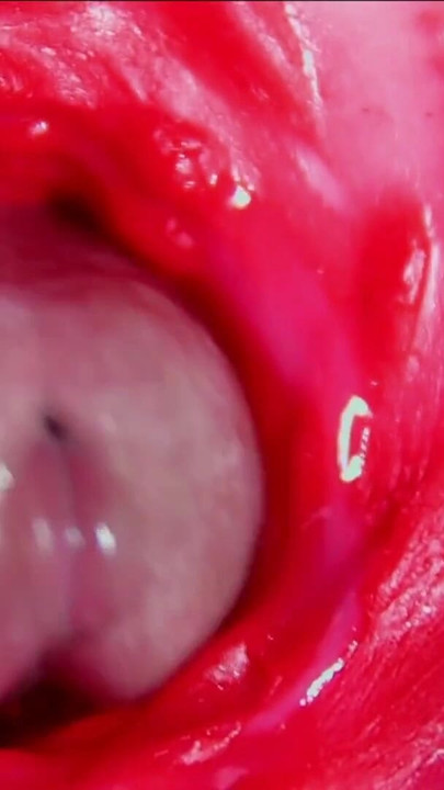 Epic moment from "Juicy beautiful pussy squelches inside ASMR close-up inside the anus"