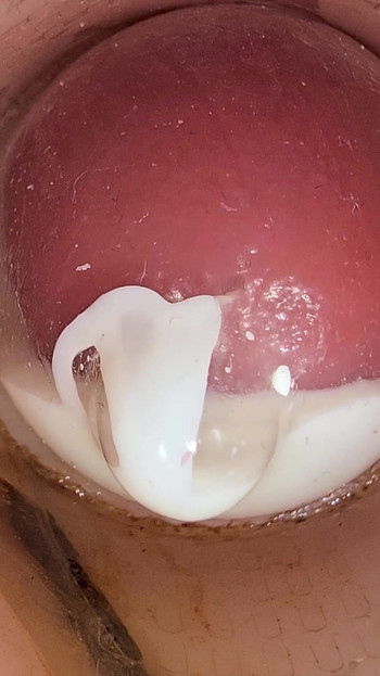Thrilling moment from "The Camera in the Deep Pussy Records a Huge Ejaculation of Sperm Into the Condom"