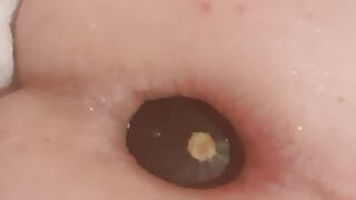 Working dilation