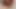 Foreskin extreme torture porn
