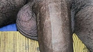 Penis pioenrozen en phimosis 2