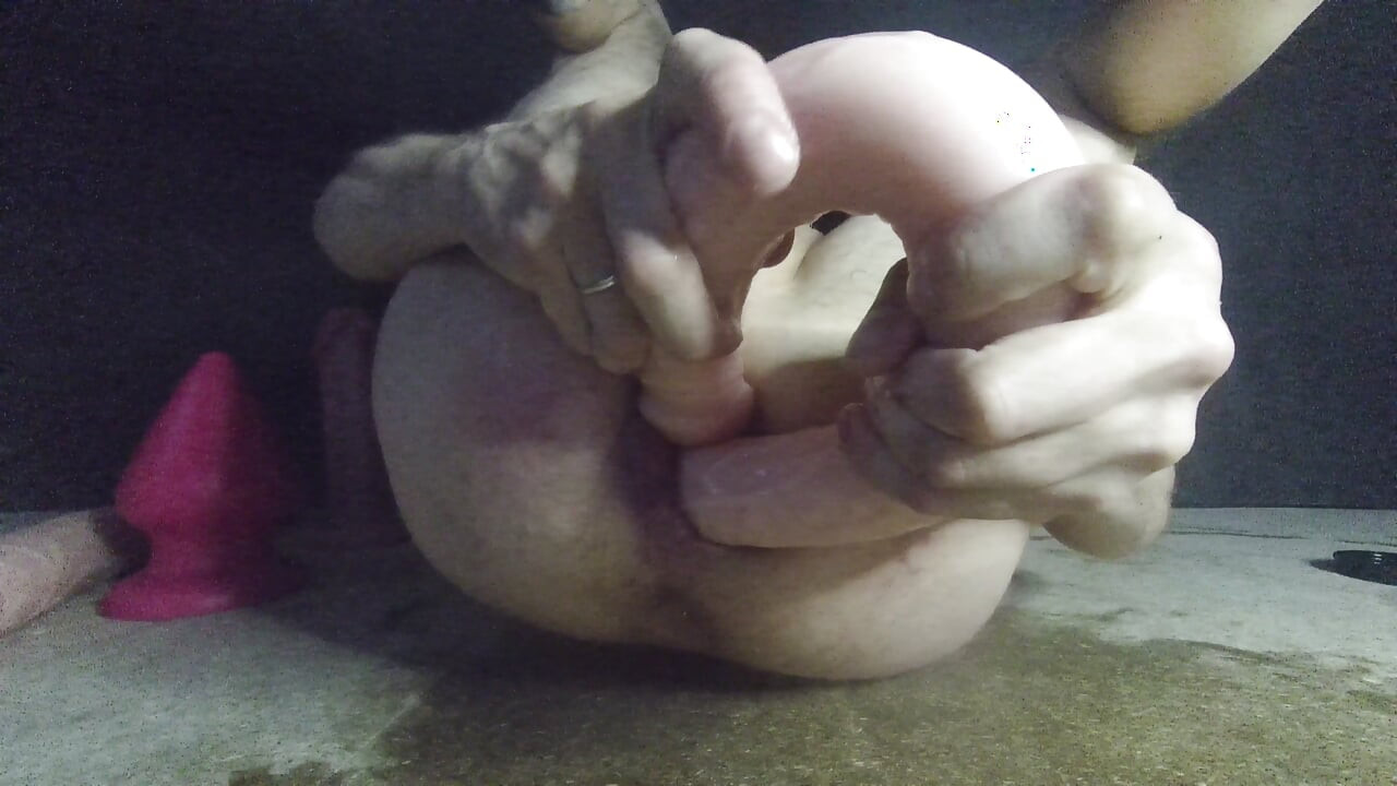 Anal prolapse