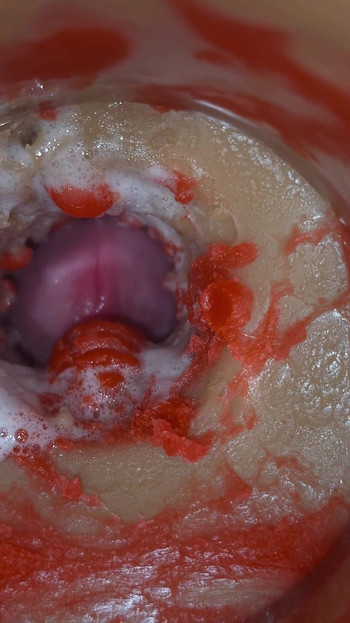 受精 - 内部カメラが男性の深射を撮影