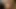 Alte Porno Nutte - Extrem Ausgeleierte Fotze Und Arsch