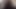 Masturbation, also banana in anal hole