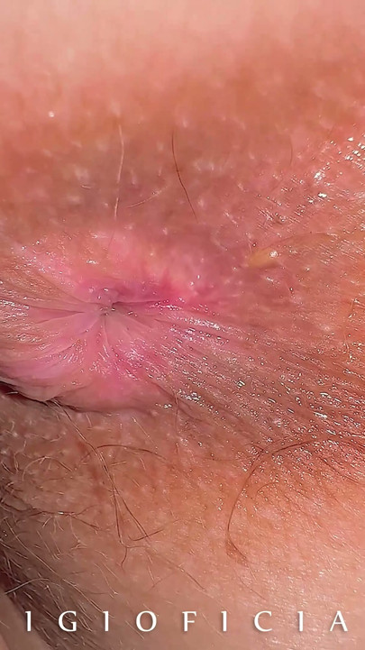 What if we take HIGH END CLOSE UP CAMERA and shot 18 years old girl butthole close up? | Clip 1