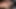 Teen Rabbit Girl Gets a Destroyed Anal Fucking - Gape, Anal