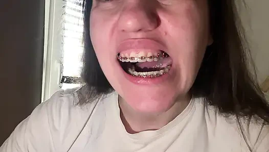 Облизывать брекеты языком