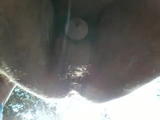 anal forest