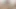 Just My Coffee Break Post-Op Orgasm Pussy Clit Masturbation Teasing Orgasm