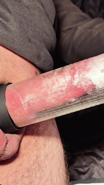 Key moment from "Huge multiple cum in a condom! I use a vacuum pump to help."