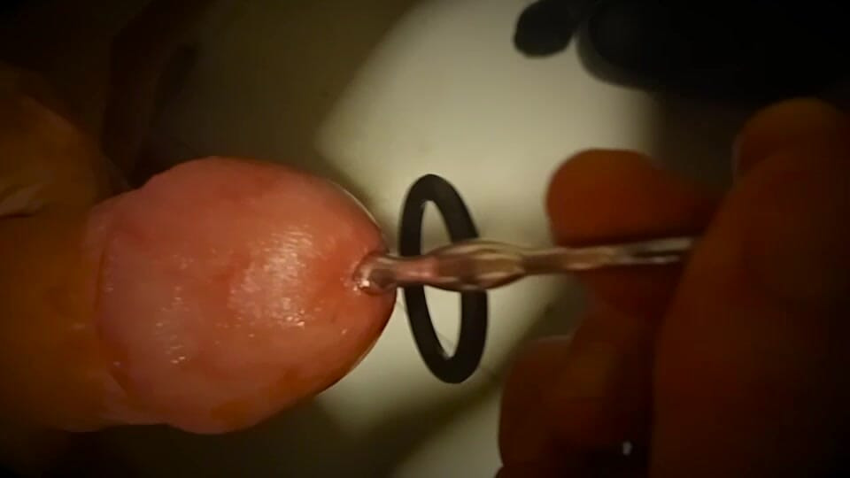 Zora Dual CD playing with urethral catheter