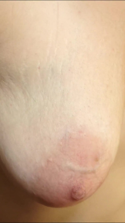 Iconic moment from "Close up tits bounsing with strech marks in slow motion"
