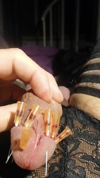 Playing with needles 5