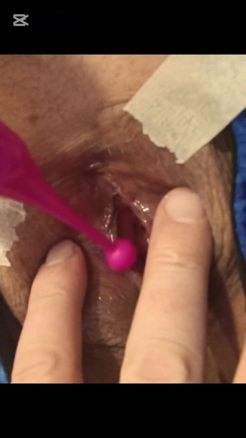 Pink clitoral toy | Clip 1