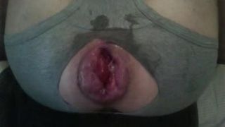 huge swallen lips  1