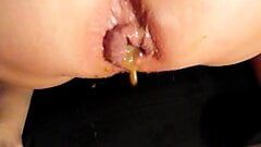 dirty anal creampie