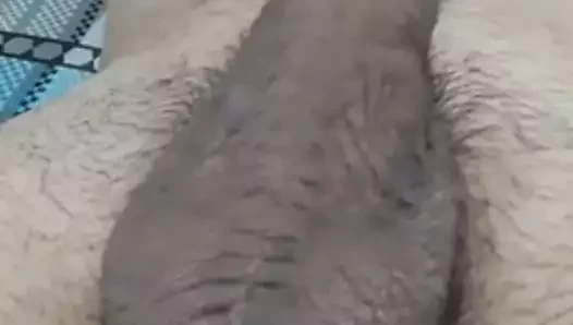 Kıllı taşaklar