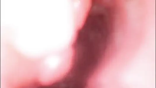 Endoscope Creampie. Cam Inside Pussy Shows Dick Cumming Inside Pussy