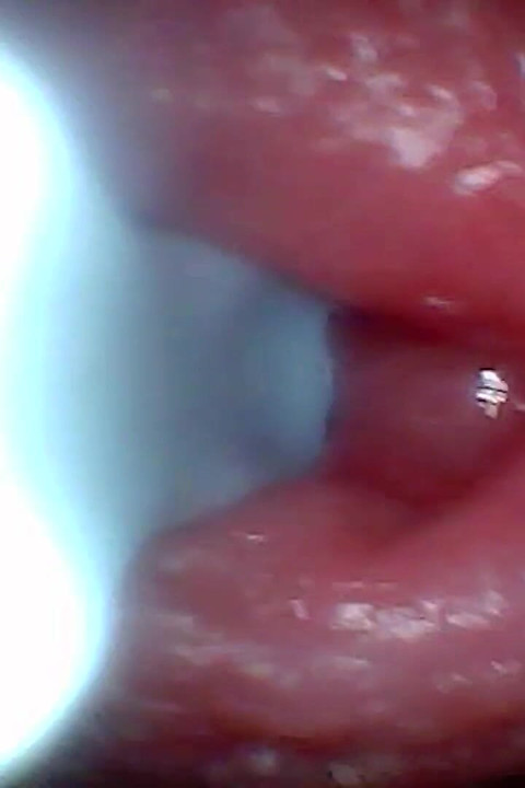 Endoscope Camera Captures Moment of Male Ejaculation 4K