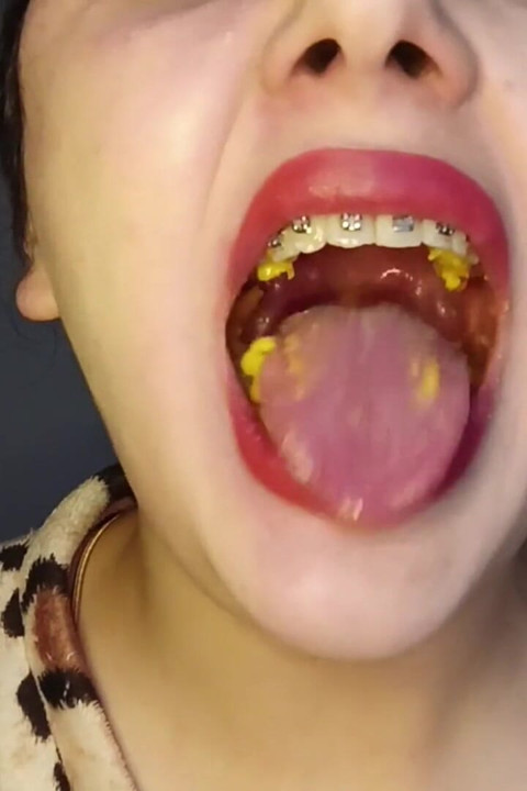 Chew Cheetos POV Uvula