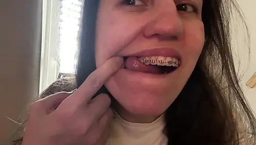 Licking Your Braces with Your Tongue