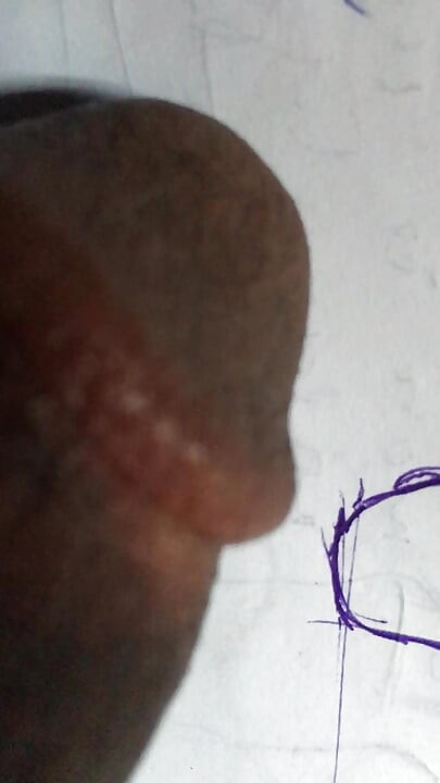 Honey after drawing