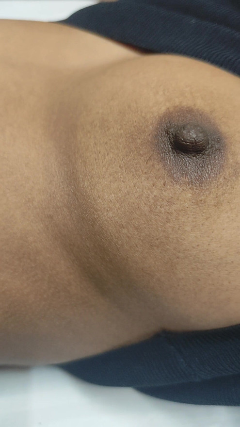 Boobs