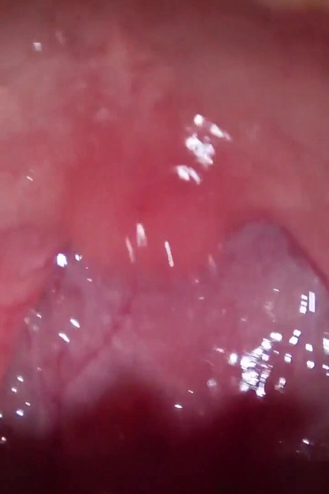 내 남친을 축소