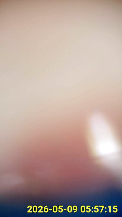 Close up of buttplug & HD Endoscope insertion