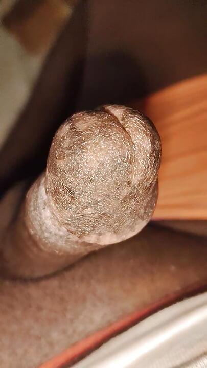 140