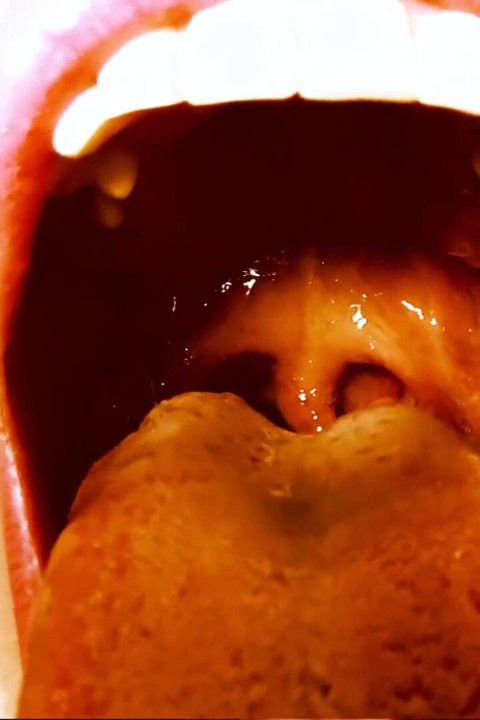 Demon Mouth Trap!