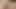 Snapping Clit With Elastic Band (Self Cunt Torture)