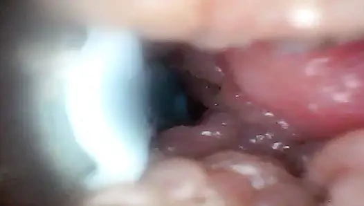 Extreme Nähe macht den Beobachter zu einem aktiven, hungrigen teilnehmer