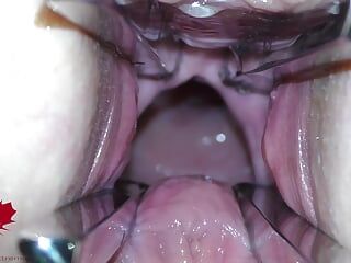 A boceta da amante é aberta com um expansor de buraco para que você possa estudar seu colo do útero.